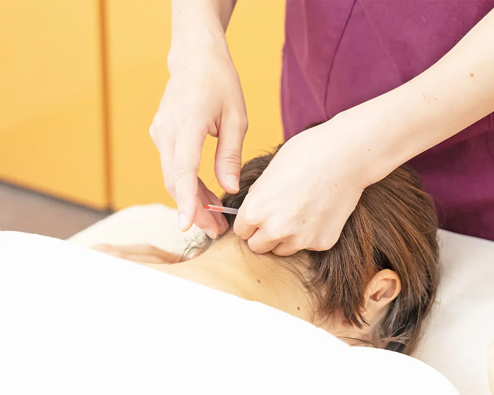首に鍼灸治療を受ける女性